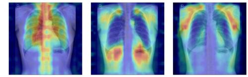 X Ŀ̼  ٰ ǵ  ָ  ðȭ ̹.