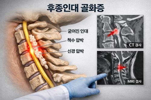 �����δ� ��ȭ��