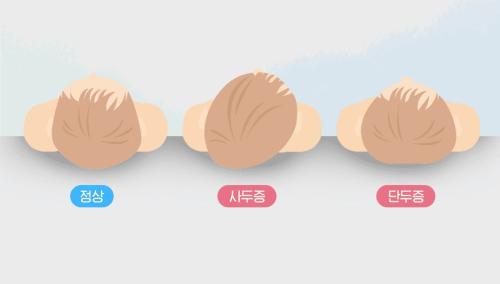 �������� �ΰ��� ���� ����