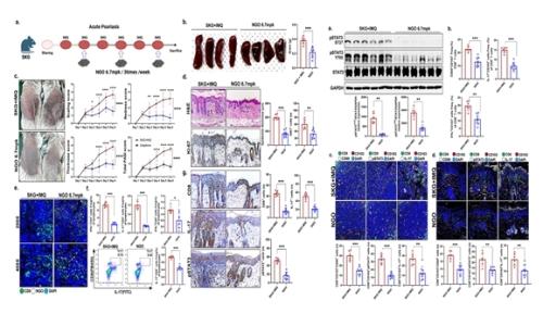 NGO�� ���� STAT3-IL-17�� �Ű� CD8+ �������ֱ�� T���� ������ ���� �Ǽ� ���콺 ���� ġ�� ȿ���� ���� ����