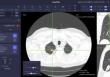 뷰노메드 흉부 CT AI™ (사진=뷰노 제공)