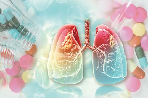 �̹��� ��ó : ��Ƽ�̹�����ũ