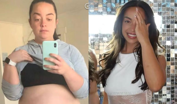 ��� �̹���