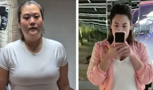 ��� �̹���