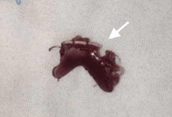 ��� �̹���