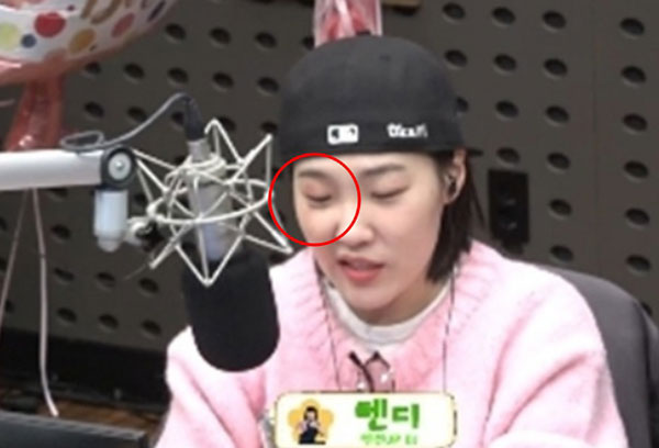 ��� �̹���