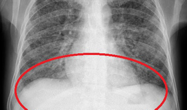 ��� �̹���