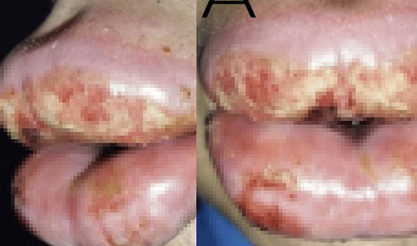 ��� �̹���