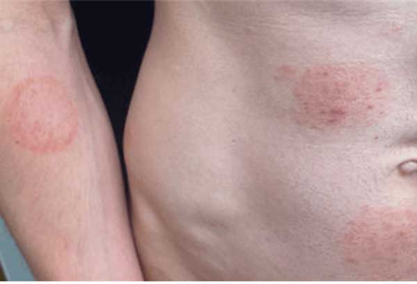 ��� �̹���