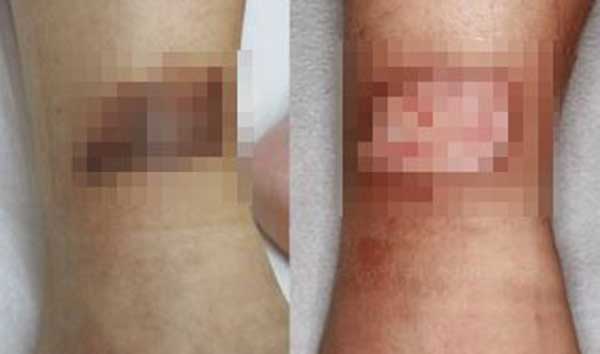 ��� �̹���