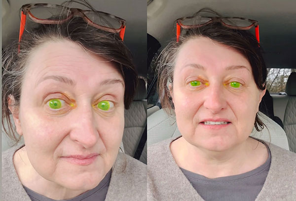 ��� �̹���