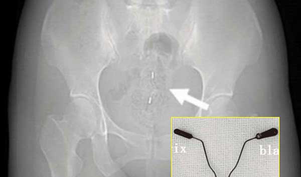 ��� �̹���