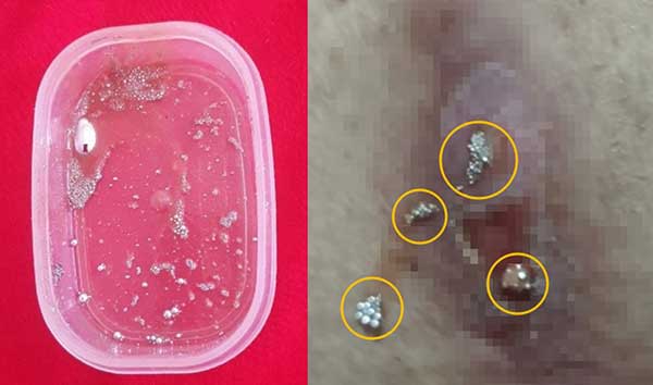 ��� �̹���