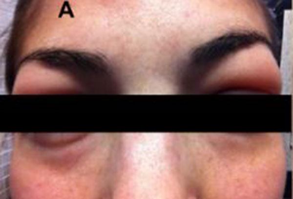 ��� �̹���