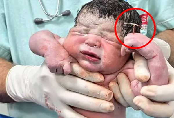 ��� �̹���