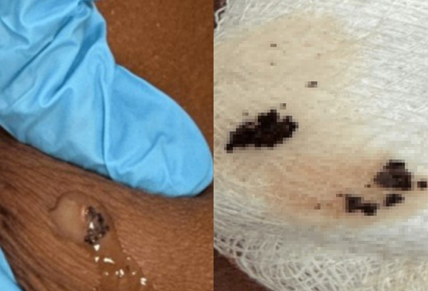 ��� �̹���