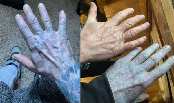 ��� �̹���