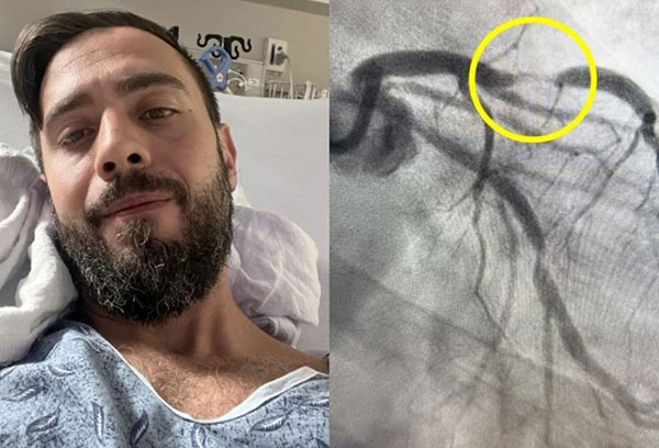 ��� �̹���