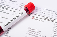 B������, '�Ը���'���� �����ɱ�? ���� �����