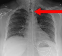 ������ ������ �Ծ� ���޼��������� '�̽���' ��.. ���� �����