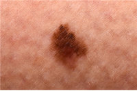 ������ģ�� ������ �� �˾Ҵµ����� ���ı⿡ �� ��, ��.. ���� �����