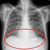 ���뺯�� ����� �ٱ۹ٱۡ��� 40�� �� ��� ����, ����.. ���� �����