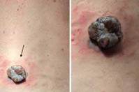 ���ܵ���̿��� ���� �ڶ󳪡��� 50�� �� �Ǻ�, ��ü ��.. ���� �����