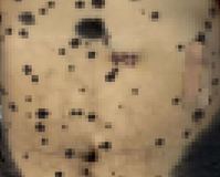 �Ǻο� ���� ���� ��Ÿ������, 5���� �� ����� 40�� .. ���� �����