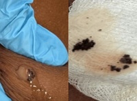 ���ۿ� ®���� �����̱��� ���١��� 20�� ��, ��ü ����.. ���� �����