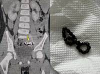 ���� �ʹ� ���ġ� 4�� ���ơ� ��ӿ� ���̰͡� �Ѱ��� ��.. ���� �����