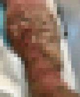 ��7�Ⱓ ������ ġ�ᡱ �������� ��ģ 60�� ��, ���� ��.. ���� �����