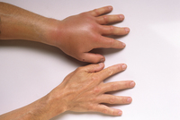 ��缱 ġ��, �������� ����� �������� ���� ���� ���� �����