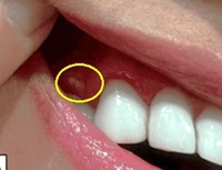 ����ġ�ϸ� ����� 80%���� 40�� ҳ �Կ� ���� ���� ����.. ���� �����