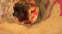 �ڳ� LDL, �θ� ���󰣴١� ��Ӵ� ���� �ִ� 7�� ���� �����