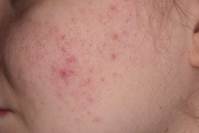 �� �ǰ� �������ٴ� ���ǿ��ǡ� ��ȣ�� ���� �����