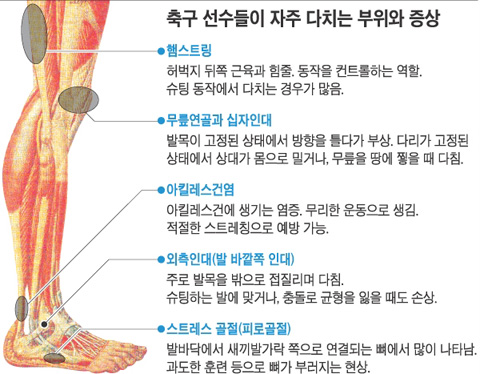 박지성과 곽태휘는 자주 다치는 부위도 달라 당신의 건강가이드 헬스조선