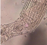 현미경으로 세균을 들여다본 사진.