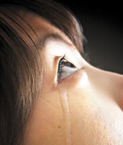 눈물흘림증 환자는 피부염 등 염증 질환이 생길 수 있으므로 초기에 대처가 필요하다.
