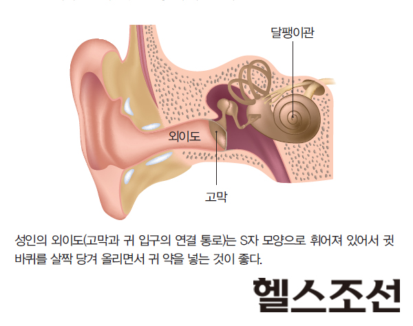 성인의 외이도(고막과 귀 입구의 연결 통로)는 S자 모양으로 휘어져 있어서 귓바퀴를 살짝 당겨 올리면서 귀 약을 넣는 것이 좋다