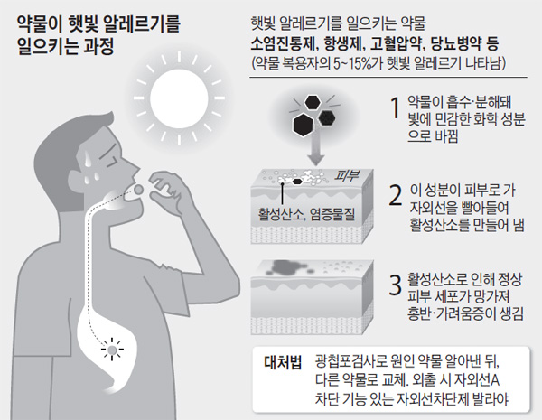 약물이 햇빛 알레르기를 일으키는 과정