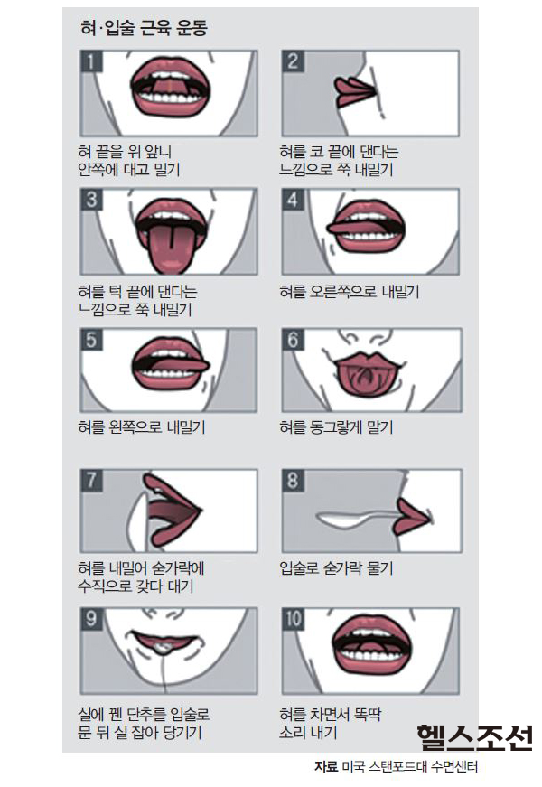 혀·입술 근육 운동