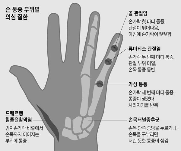 손 통증 부위별 의심 질환 정리 그래픽