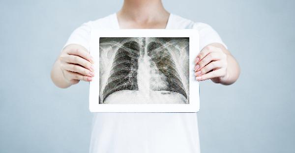 폐 엑스레이 사진 들고 있는 모습