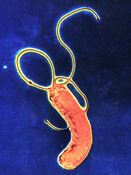 세균 현미경 사진