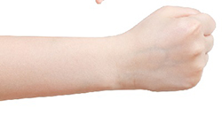What is the risk of fingertip numbness and wrist tunnel syndrome?