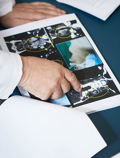 갑상선암이 전이된 환자의 MRI 사진