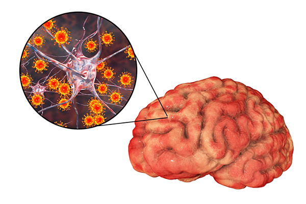 바이러스와 뇌 모델 사진