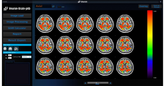 Veuron-Brain-pAb