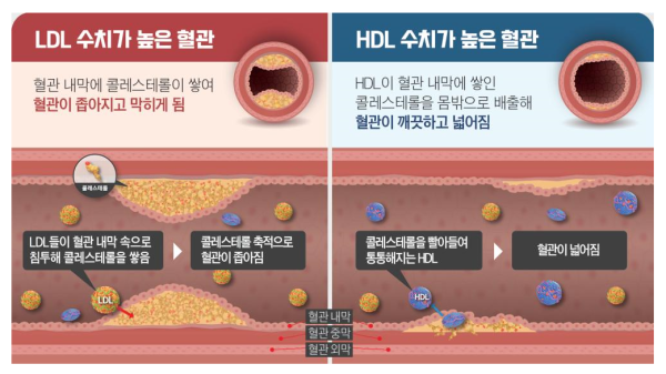 콜레스테롤 ldl LDL HDL
