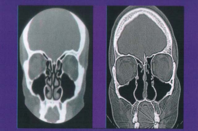 CT����
